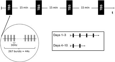 Theta-Burst Stimulation for Auditory-Verbal Hallucination in Very-Late-Onset Schizophrenia-Like Psychosis—A Functional Magnetic Resonance Imaging Case Study